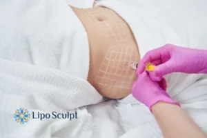 Are The Results From Aqualyx Permanent? 1 Do you want to know how long Aqualyx Buckingham results last?