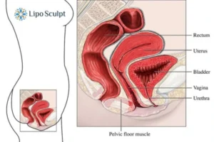 Treatment For A Leaky Bladder 2 How EM Chair treatment Buckingham can help Leaky bladder issues. Read more now!
