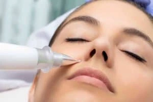 Best Actinic Keratoses Removal 3 Actinic keratoses Buckingham solutions - book in today!