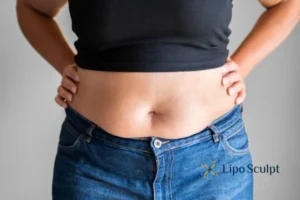 Bidding Farewell to Muffin Tops with Aqualyx Fat Injections 2 Do you wish you could reduce your muffin top Buckingham With Aqualy fat dissolving injections you can!