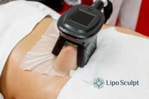 Does Fat Freezing At Home Work? 3 Fat freezing at home from Lipo Sculpt Buckingham